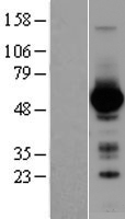 GATA4 Human Over-expression Lysates NM_002052