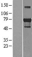 GATA6 Human Over-expression Lysates NM_005257