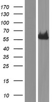 GBA Human Over-expression Lysates NM_001005742