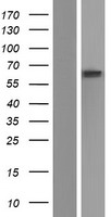 ls002629 gba human over expression lysates nm 001171812 wb testing 5