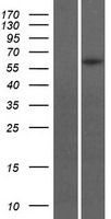 GBX1 Human Over-expression Lysates NM_001098834