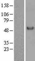 Vitamin D Binding protein (GC) Human Over-expression Lysates NM_000583