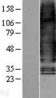 ls002642 glucagon receptor gcgr human over expression lysates nm 000160 wb testing 1
