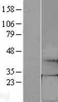 ls002643 gtp cyclohydrolase 1 gch1 human over expression lysates nm 001024024 wb testing 2