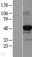 Glucokinase (GCK) Human Over-expression Lysates NM_000162