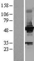 Glucokinase (GCK) Human Over-expression Lysates NM_033508