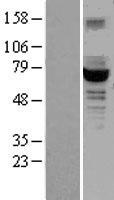 GCKR Human Over-expression Lysates NM_001486
