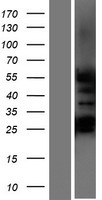 GCNF (NR6A1) Human Over-expression Lysates NM_001489