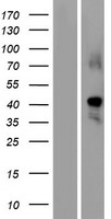 GDF1 Human Over-expression Lysates NM_001492