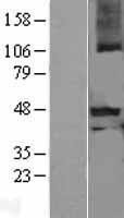 Myostatin Propeptide (MSTN) Human Over-expression Lysates NM_005259
