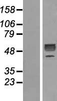 GDF 9 (GDF9) Human Over-expression Lysates NM_005260