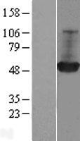 GDI1 Human Over-expression Lysates NM_001493