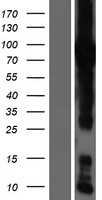 GFPT1 Human Over-expression Lysates NM_002056