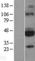 GFR alpha 3 (GFRA3) Human Over-expression Lysates NM_001496