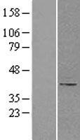 B4GALT1 Human Over-expression Lysates NM_001497