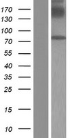 GGT7 Human Over-expression Lysates NM_178026
