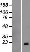 Growth Hormone (GH1) Human Over-expression Lysates NM_022559