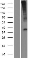 GHRHR Human Over-expression Lysates NM_001009824