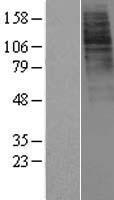 Ghrelin Receptor (GHSR) Human Over-expression Lysates NM_004122