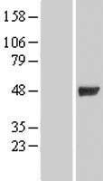 Intrinsic Factor (GIF) Human Over-expression Lysates NM_005142