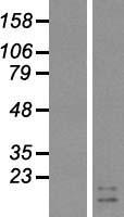 GIP Human Over-expression Lysates NM_004123
