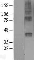 Gastric Inhibitory Polypeptide Receptor (GIPR) Human Over-expression Lysates NM_000164