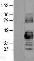 GJA1 Human Over-expression Lysates NM_000165