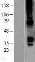 GJA5 Human Over-expression Lysates NM_005266