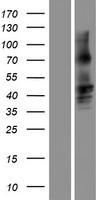 GJA8 Human Over-expression Lysates NM_005267