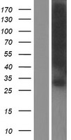 GJB1 Human Over-expression Lysates NM_000166