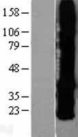 GJB2 Human Over-expression Lysates NM_004004