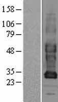 GJB3 Human Over-expression Lysates NM_024009