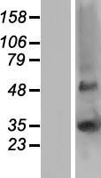 GJB5 Human Over-expression Lysates NM_005268