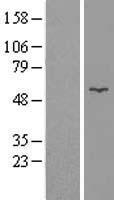 Glycerol kinase (GK) Human Over-expression Lysates NM_203391