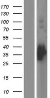 GCLM Human Over-expression Lysates NM_002061