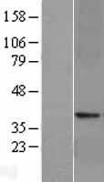 ls002740 glp1r human over expression lysates nm 002062 wb testing 1