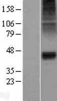 alpha 1 Glycine Receptor (GLRA1) Human Over-expression Lysates NM_000171