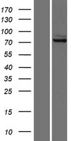 Glutaminase (GLS) Human Over-expression Lysates NM_014905