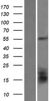 GLUD2 Human Over-expression Lysates NM_012084