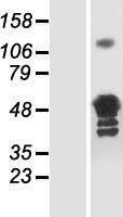 Glutamine Synthetase (GLUL) Human Over-expression Lysates NM_001033044