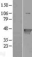 Glutamine Synthetase (GLUL) Human Over-expression Lysates NM_001033056