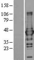 Glutamine Synthetase (GLUL) Human Over-expression Lysates NM_002065