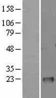 GM2A Human Over-expression Lysates NM_000405