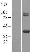 GMDS Human Over-expression Lysates NM_001500