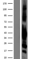 G protein alpha inhibitor 1 (GNAI1) Human Over-expression Lysates NM_002069