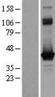 ls002775 g0 protein alpha gnao1 human over expression lysates nm 020988 wb testing 1