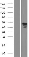 G protein alpha S (GNAS) Human Over-expression Lysates NM_001077488
