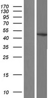 G protein alpha S (GNAS) Human Over-expression Lysates NM_001077489
