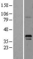 G protein alpha S (GNAS) Human Over-expression Lysates NM_016592