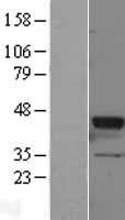 GNAT2 Human Over-expression Lysates NM_005272